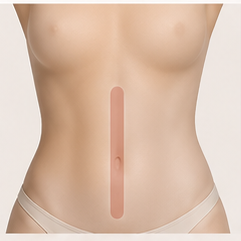 Línea abdomen