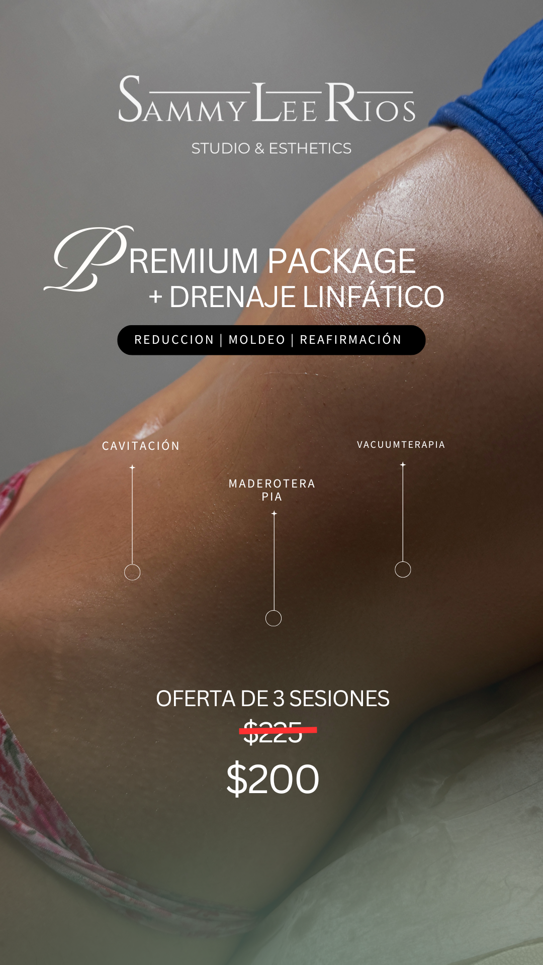 OFERTA: PREMIUM PACKAGE